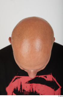 Photos Bobby Hyde bald head 0006.jpg